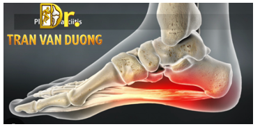 Hình minh họa chẩn đoán Viêm Cân Gan Chân – Bác sĩ Trần Văn Dương (TP.HCM)