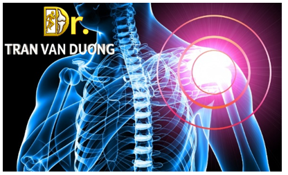 Hình minh họa Rách Chóp Xoay - Bác sĩ CK2 Trần Văn Dương (TP. HCM)