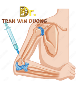 Hình minh họa tiêm khớp vai để điều trị Viêm Mỏm Lồi Cầu Ngoài Xương Cánh Tay – Bác sĩ CK2 Trần Văn Dương (TP.HCM)