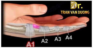 Hình minh họa Ngón Tay Cò Súng – Bác sĩ CK2 Trần Văn Dương (TP. HCM)