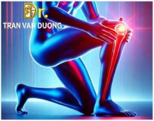 Hình minh họa vị trí đau đầu gối – Bác sĩ CK2 Trần Văn Dương (TP.HCM)