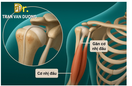 Hình minh họa cấu trúc gân nhị đầu - BS Trần Văn Dương (TP. HCM)