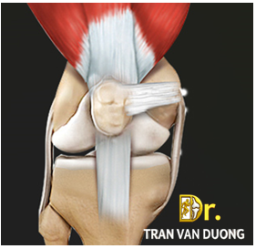 Hình minh họa đau đầu gối trong Viêm Khớp Chè Đùi – Bác sĩ Trần Văn Dương (TP.HCM)