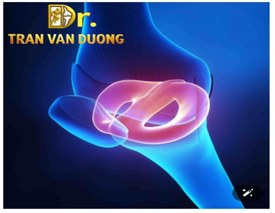 SỤN CHÊM HÌNH DĨA – BS Trần Văn Dương (TP.HCM)