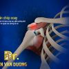 HỘI CHỨNG CHÈN ÉP VAI – BS Trần Văn Dương (TP. HCM)