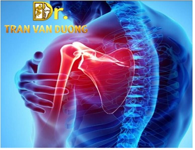 ĐAU VAI GÁY | BS TRẦN VĂN DƯƠNG (TP.HCM)