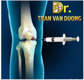 Hình minh họa tiêm nội khớp để điều trị Thoái Hóa Khớp Gối – Bác sĩ Trần Văn Dương (TP.HCM)