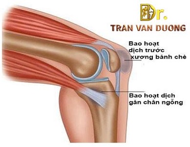VIÊM BAO HOẠT DỊCH GÂN CHÂN NGỖNG ĐẦU GỐI