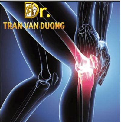 Hình minh họa vị trí đau trong Thoái Hóa Khớp Gối – Bác sĩ Trần Văn Dương (TP.HCM)