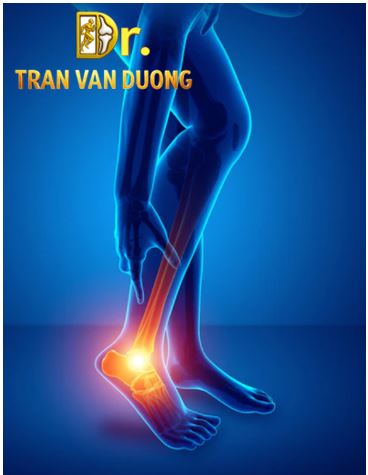 Chấn thương bàn chân