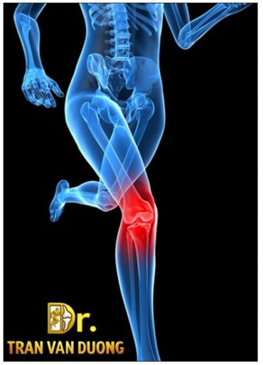 Chấn thương đầu gối