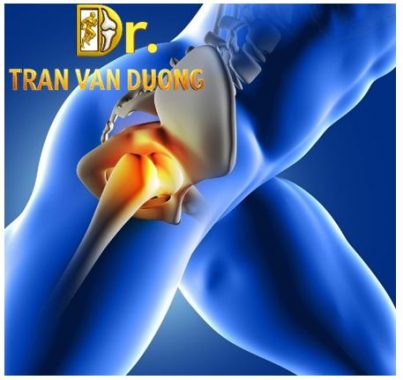 Chấn thương vùng hông