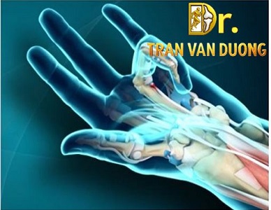 HỘI CHỨNG NGÓN TAY BẬT (NGÓN TAY CÒ SÚNG) | BS Trần Văn Dương TP.HCM