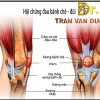 HỘI CHỨNG ĐAU BÁNH CHÈ ĐÙI – BS Trần Văn Dương (TP.HCM)
