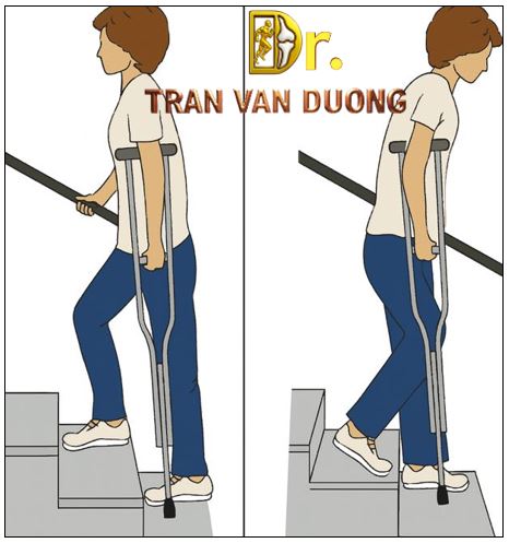 Tập lên xuống cầu thang đúng cách sau thay khớp gối – Bác sĩ Trần Văn Dương (TP.HCM)