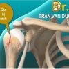 RÁCH GÂN NHỊ ĐẦU Ở VAI: HIỂU ĐÚNG ĐỂ ĐIỀU TRỊ HIỆU QUẢ