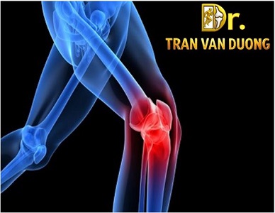 VIÊM KHỚP GỐI – BS CK2 Trần Văn Dương (TP. HCM)