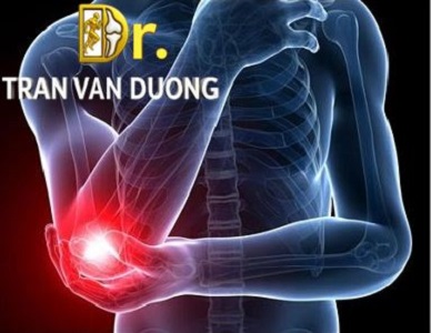 VIÊM MỎM LỒI CẦU NGOÀI XƯƠNG CÁNH TAY – BS Trần Văn Dương (TP.HCM)