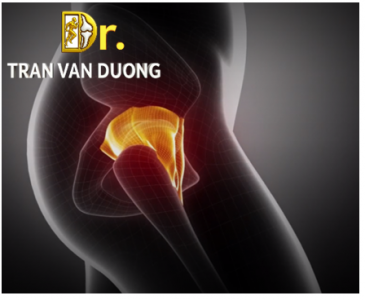Hình minh họa vị trí đau trong Thoái Hóa Khớp Háng – Bác sĩ Trần Văn Dương (TP.HCM)