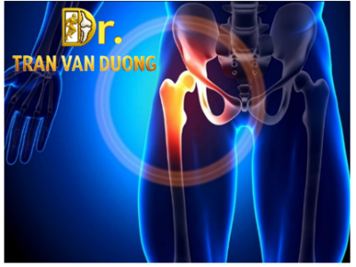 Hình minh họa vị trí đau hông, đau háng, cơn đau không chừa một ai nên đừng chủ quan – Bác sĩ Trần Văn Dương (TP.HCM)