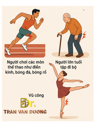 Hình minh họa những người dễ gặp Chấn Thương Cơ Gân Kheo hay Căng Cơ Gân Kheo